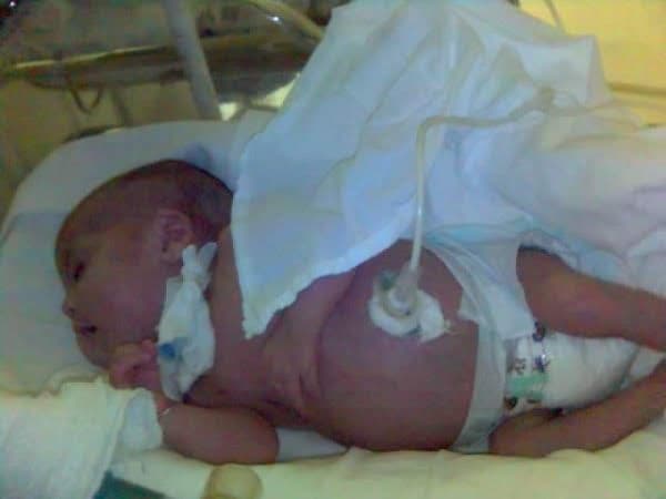 João Pedro ainda bebê na UTI neonatal